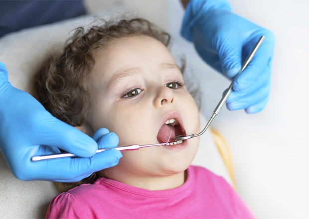 Tratamientos Infantiles Plan PADIEX Clínica Dental Javier Vaquero - Plasencia