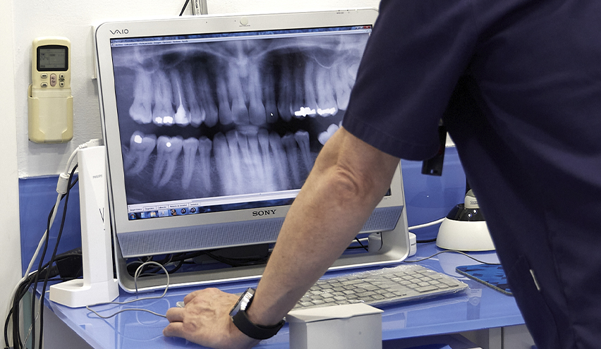 Revisión de Radiografía Clínica Dental Javier Vaquero - Plasencia