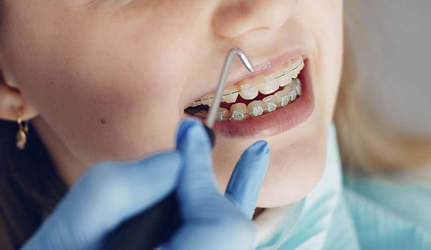 Ortodoncia Clínica Dental Javier Vaquero - Plasencia