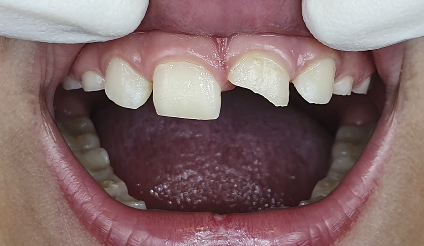 Especialistas en Odontopediatría