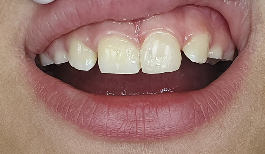 Especialistas en Odontopediatría